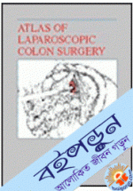 Atlas of Laparoscopic Colon Surgery (Hardcover)